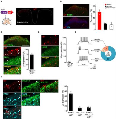 Selective Involvement of a Subset of Spinal Dorsal Horn Neurons Operated by a Prodynorphin Promoter in Aβ Fiber-Mediated Neuropathic Allodynia-Like Behavioral Responses in Rats